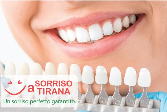 Estetica dentale, Impianti dentali, impianti dentali costo, impianti dentali albania impianto dentale completo, impianti dentali tirana, impianto dentale quanto dura